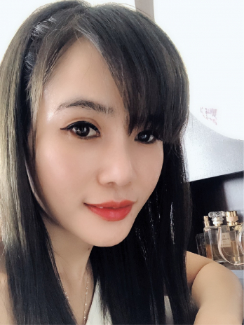 【阿春】自體脂肪-全臉填補-揮別凹陷苦情臉,逆齡超有感!