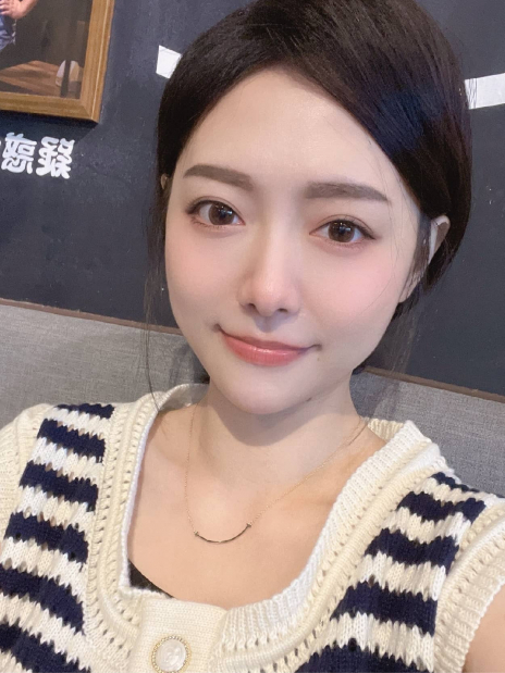 【若亞】VOLUX+ VOLUMA 喬雅登玻尿酸下巴/側頰-超玩美上相瓜子臉