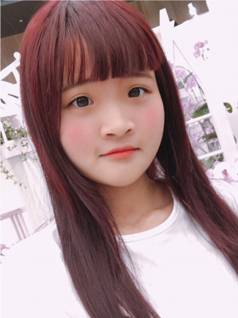 【柚柚】縫雙眼皮+開眼頭-量身規劃精緻眼形，自然水汪少女眼