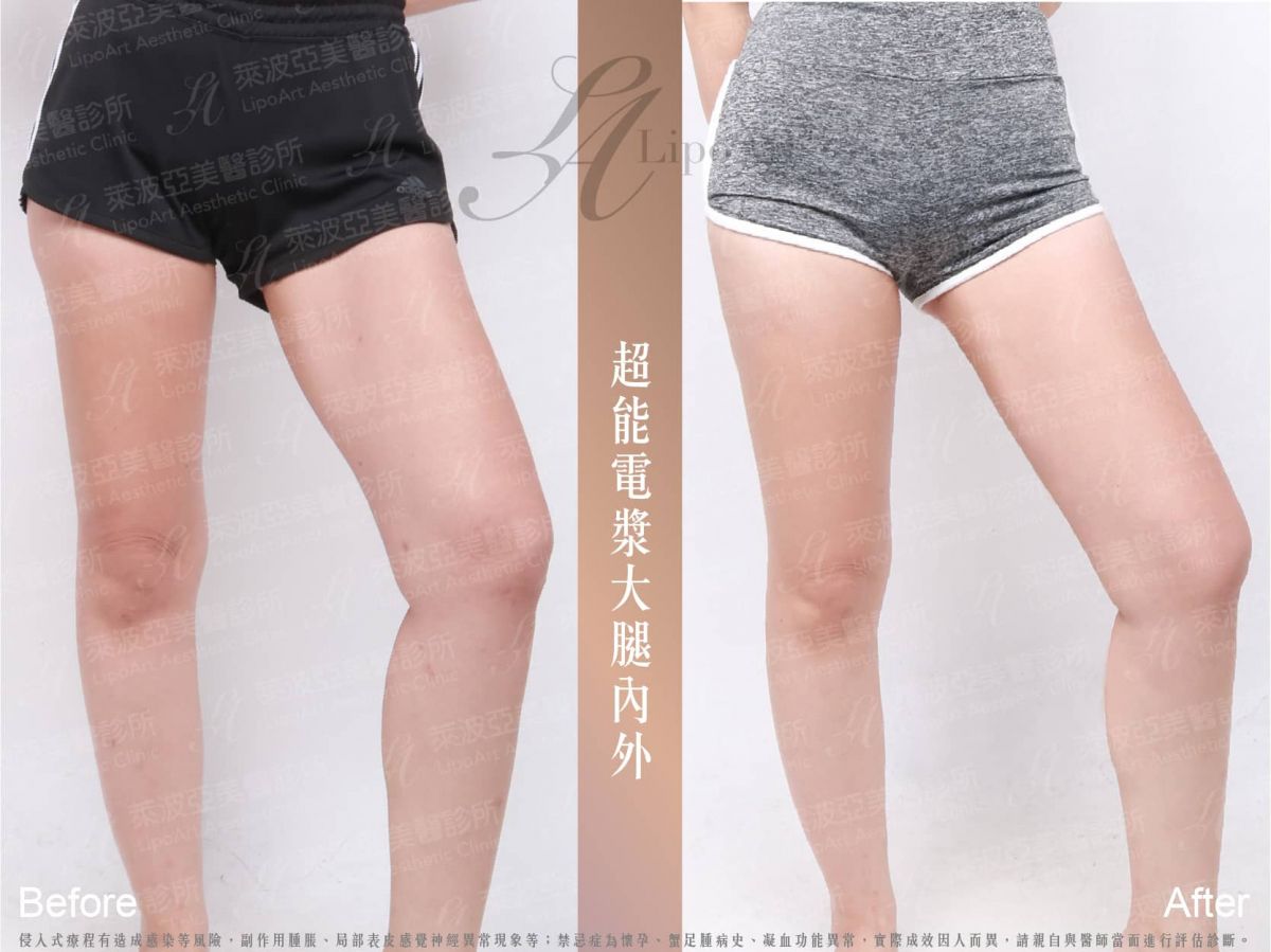 萊波亞