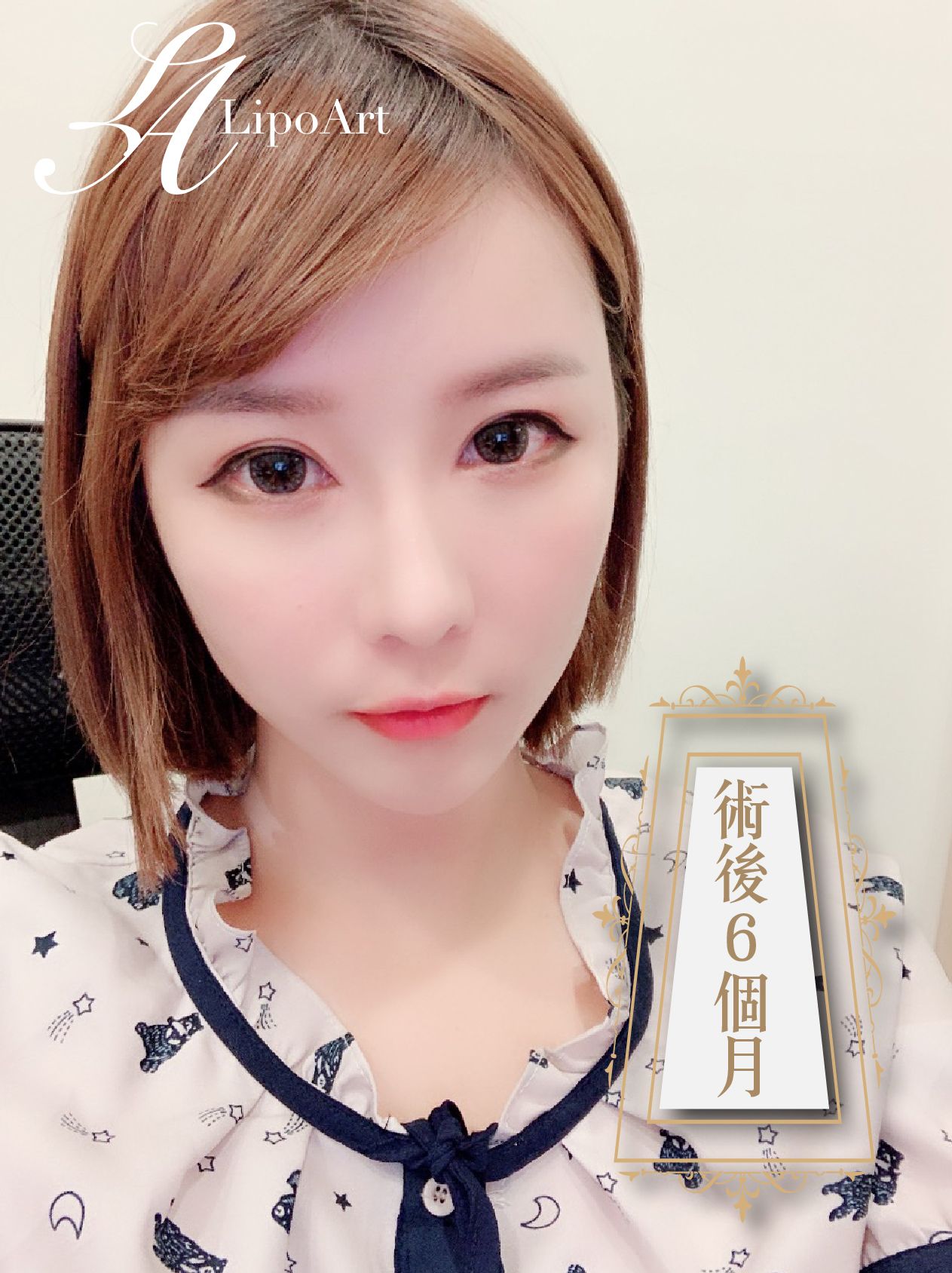 萊波亞