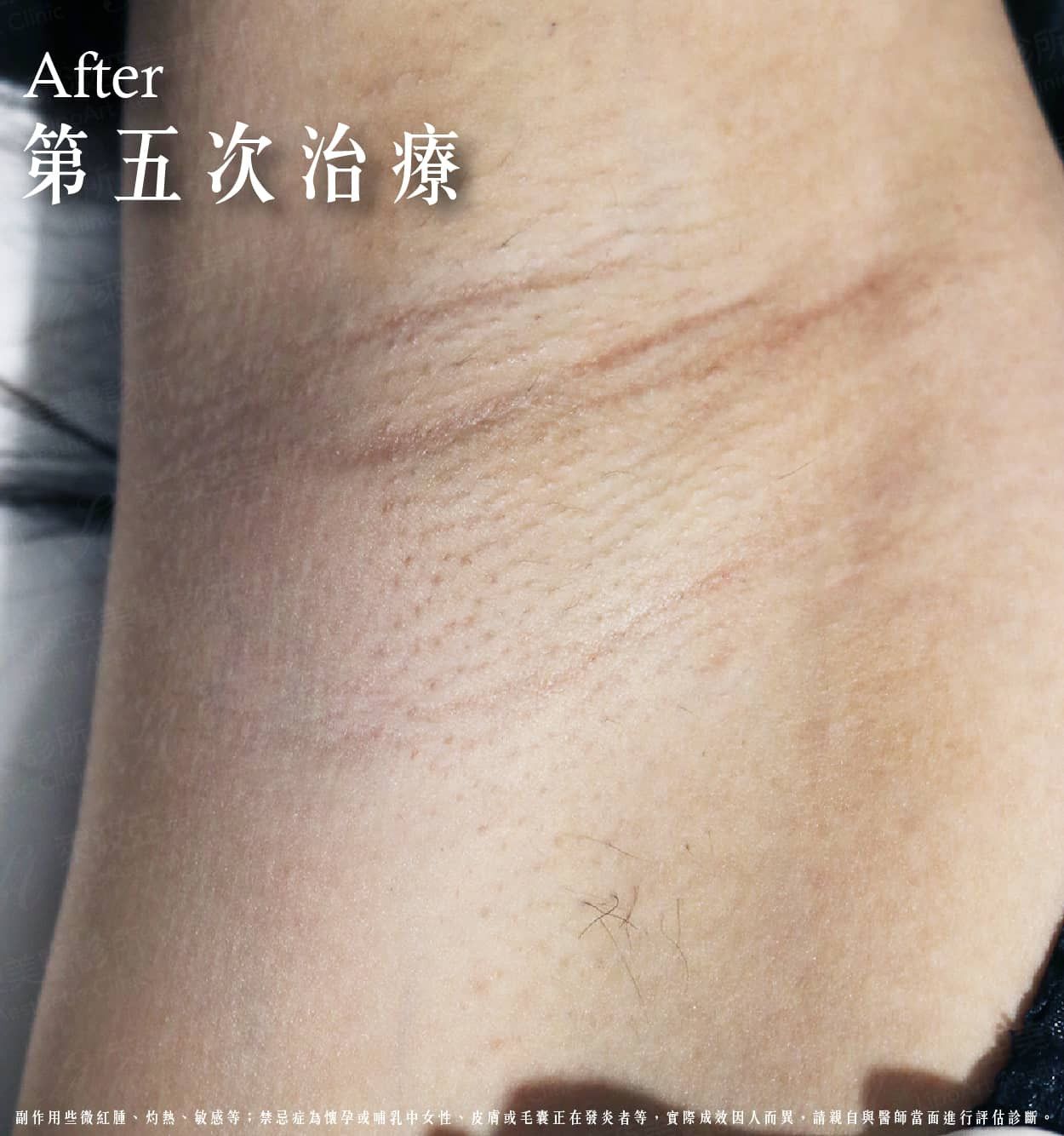 萊波亞