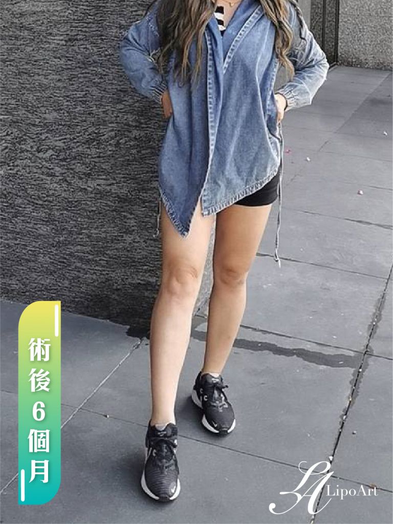 萊波亞