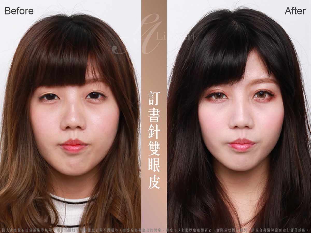 萊波亞