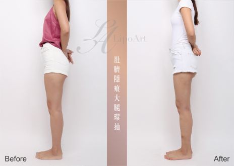 萊波亞 