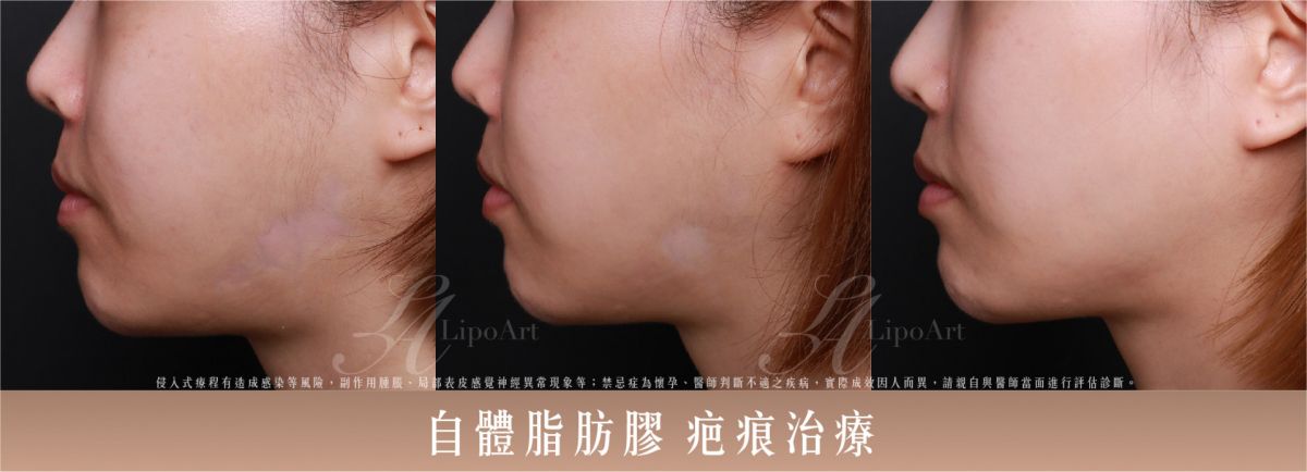 萊波亞