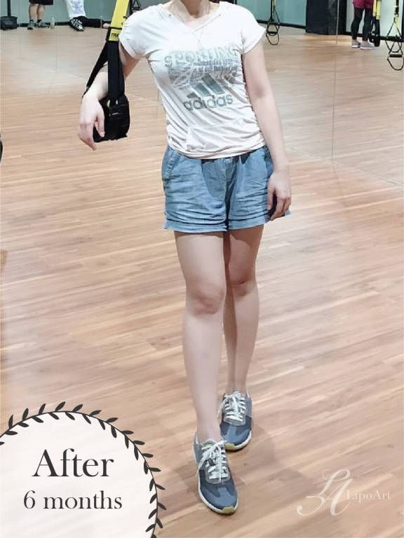 萊波亞