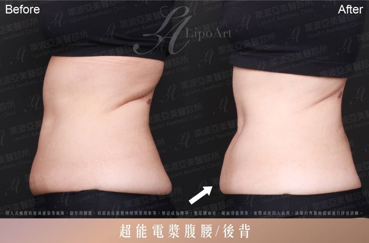 萊波亞