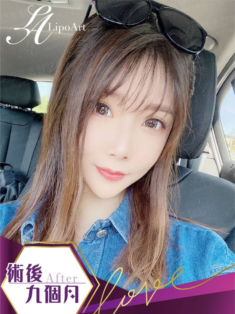 萊波亞
