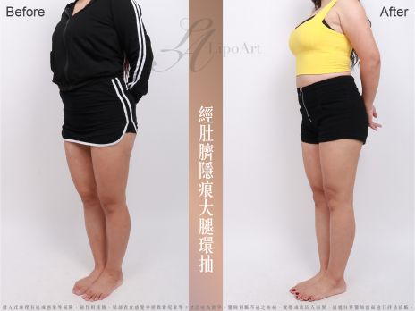 萊波亞 