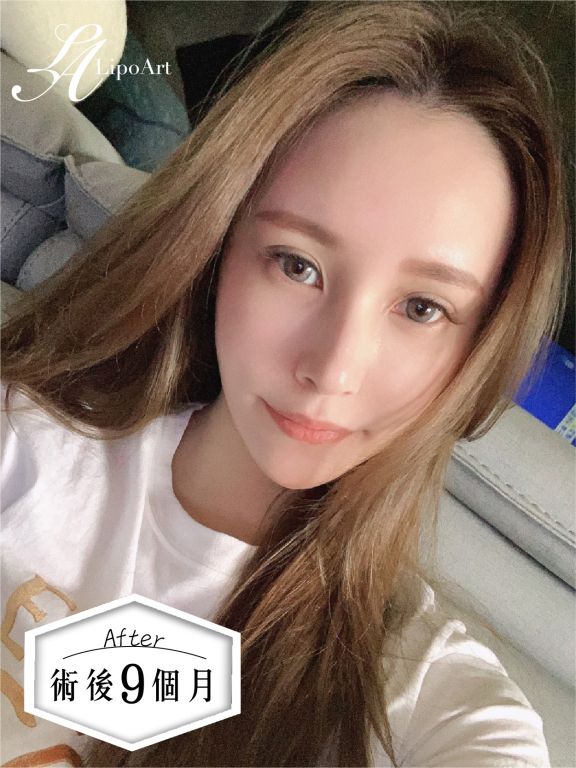 萊波亞