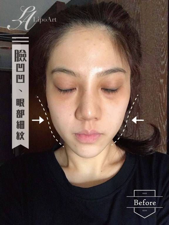 萊波亞