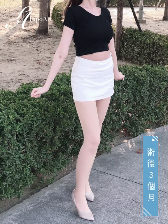萊波亞