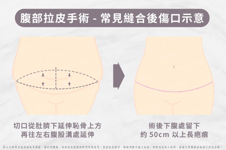 萊波亞