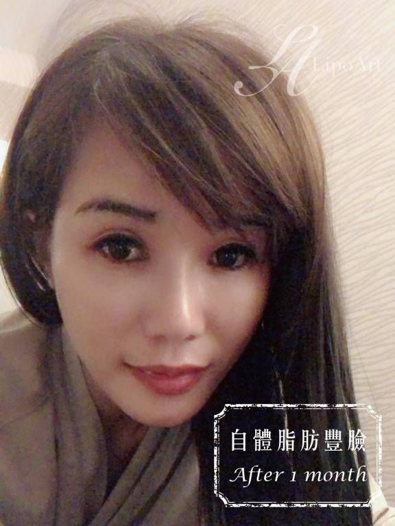 萊波亞