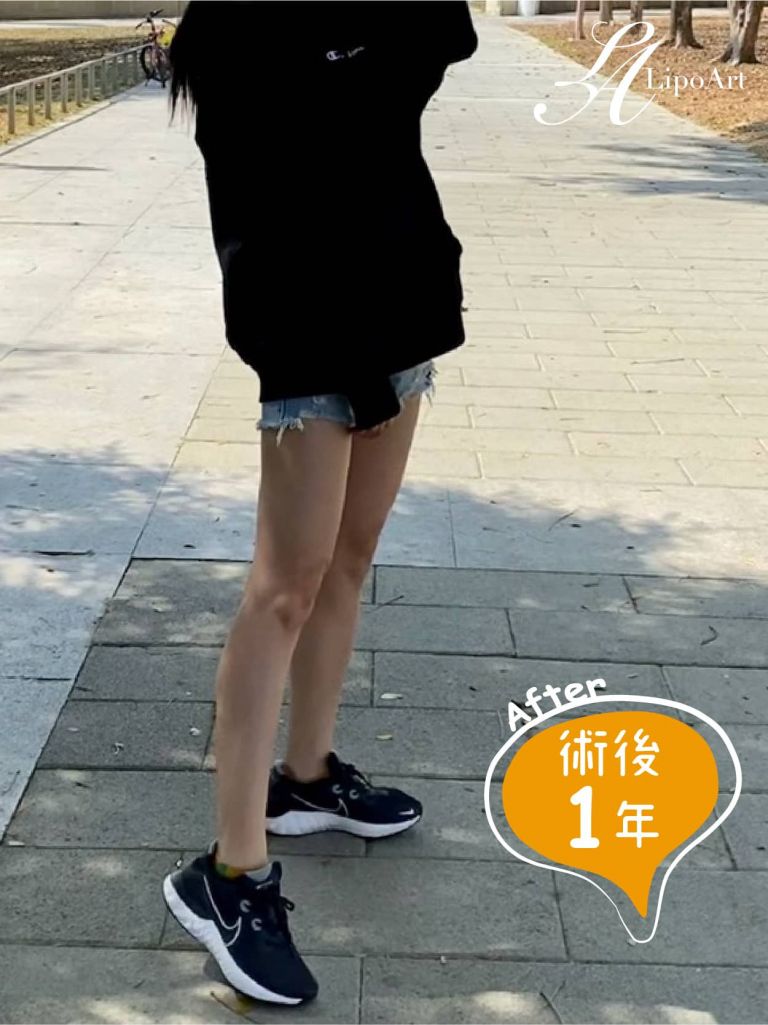 萊波亞