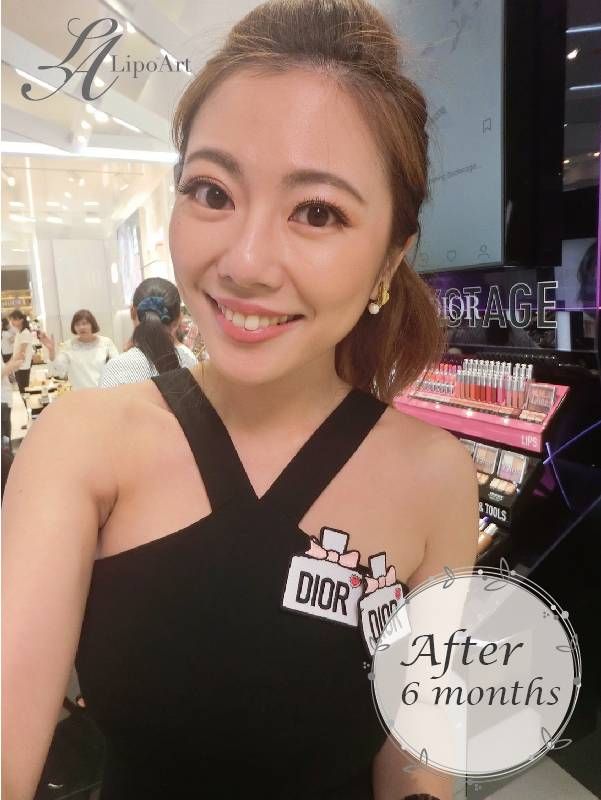 萊波亞