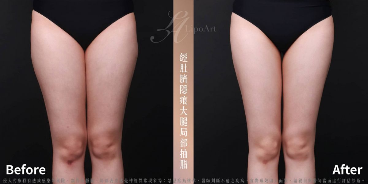 萊波亞