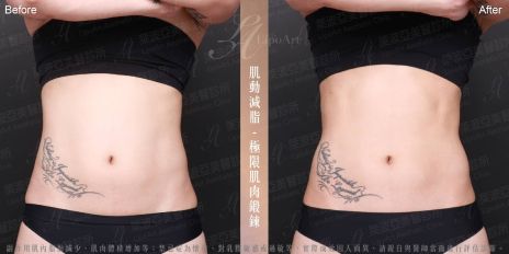 萊波亞 