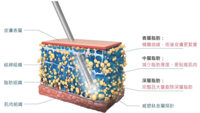 萊波亞
