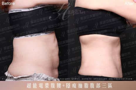 萊波亞 