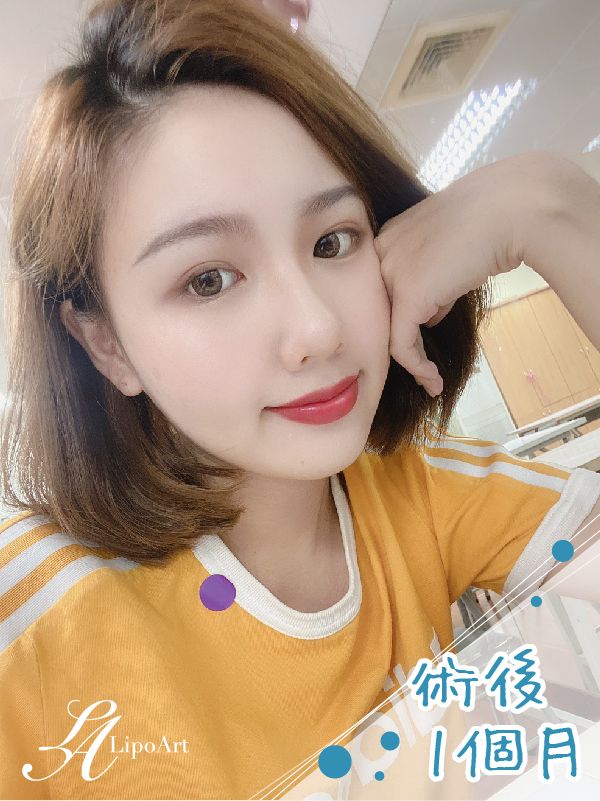 萊波亞