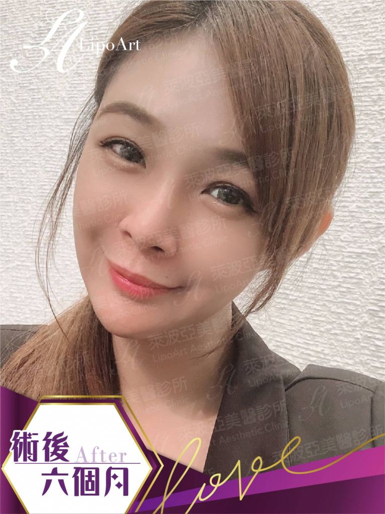 萊波亞
