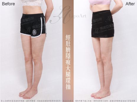 萊波亞
