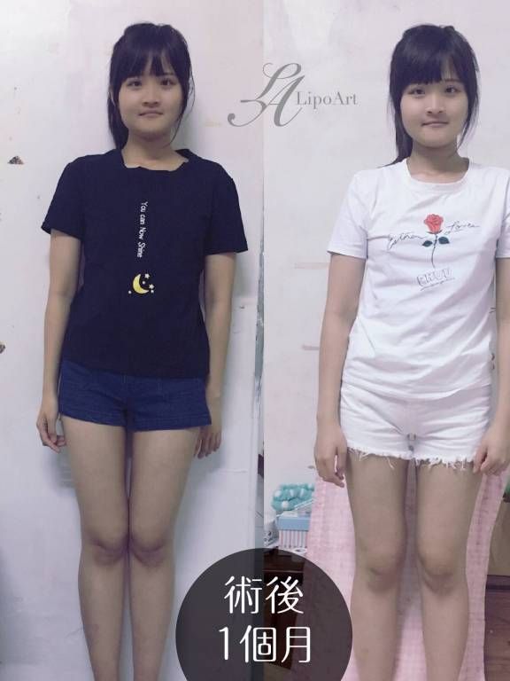 萊波亞