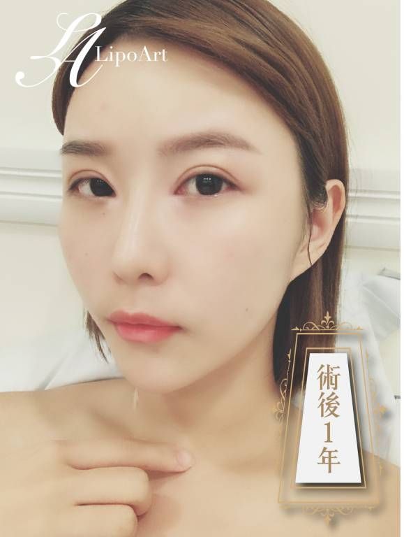 萊波亞