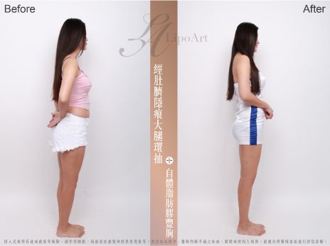 萊波亞 