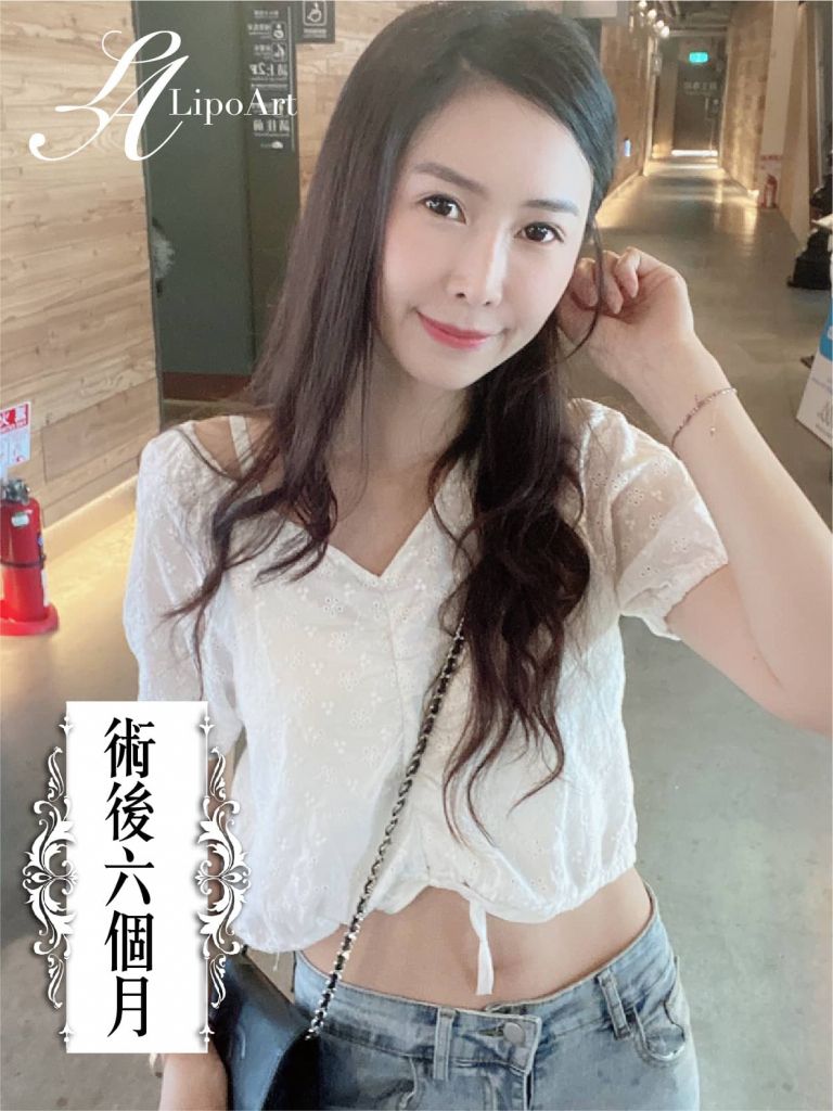 萊波亞
