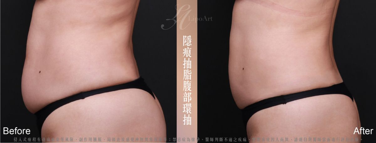 萊波亞