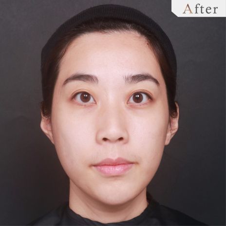 After