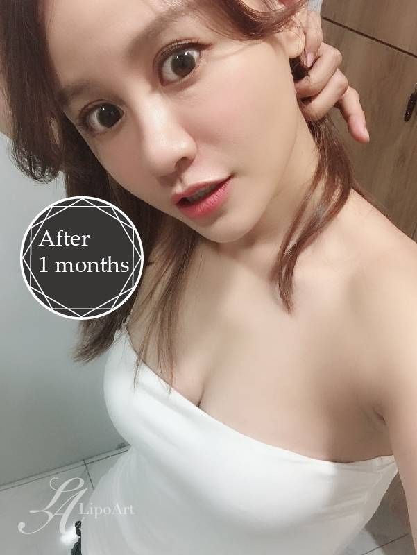 萊波亞