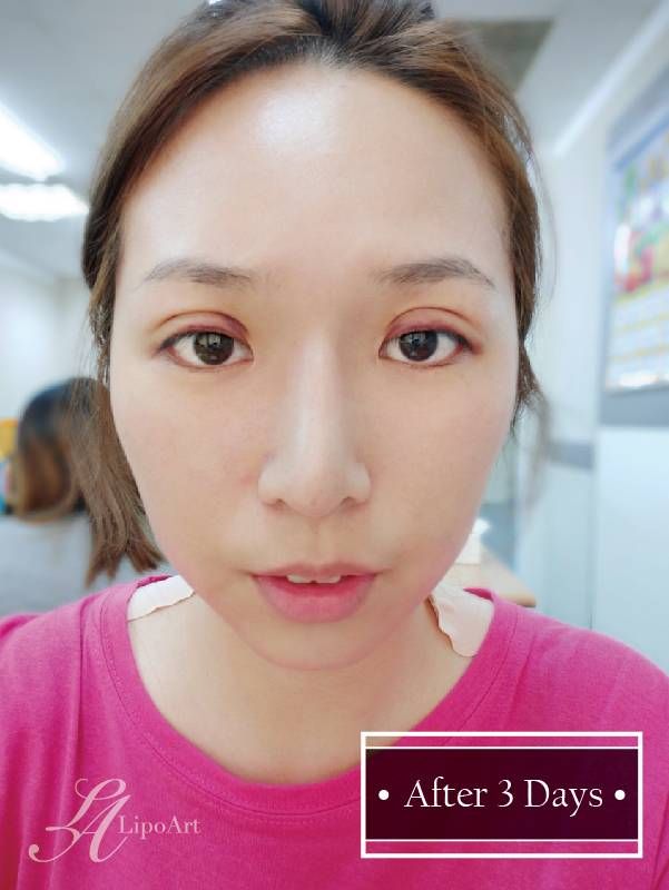 萊波亞