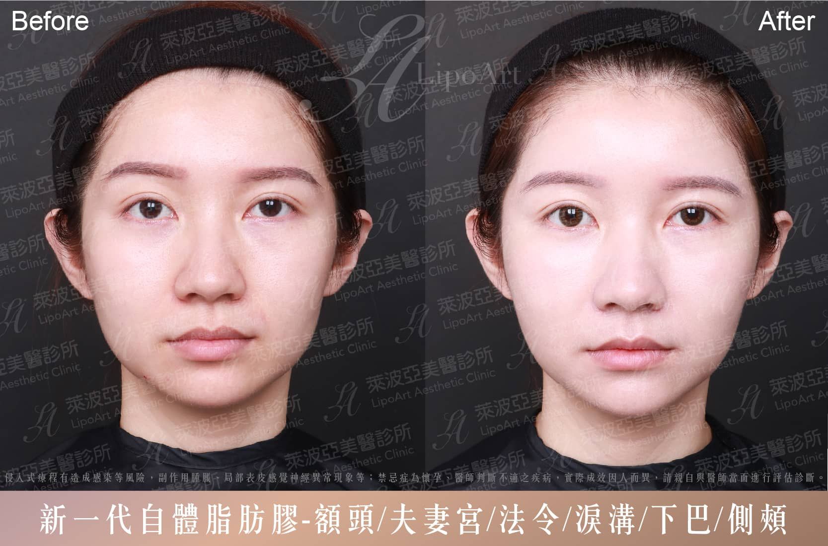 萊波亞