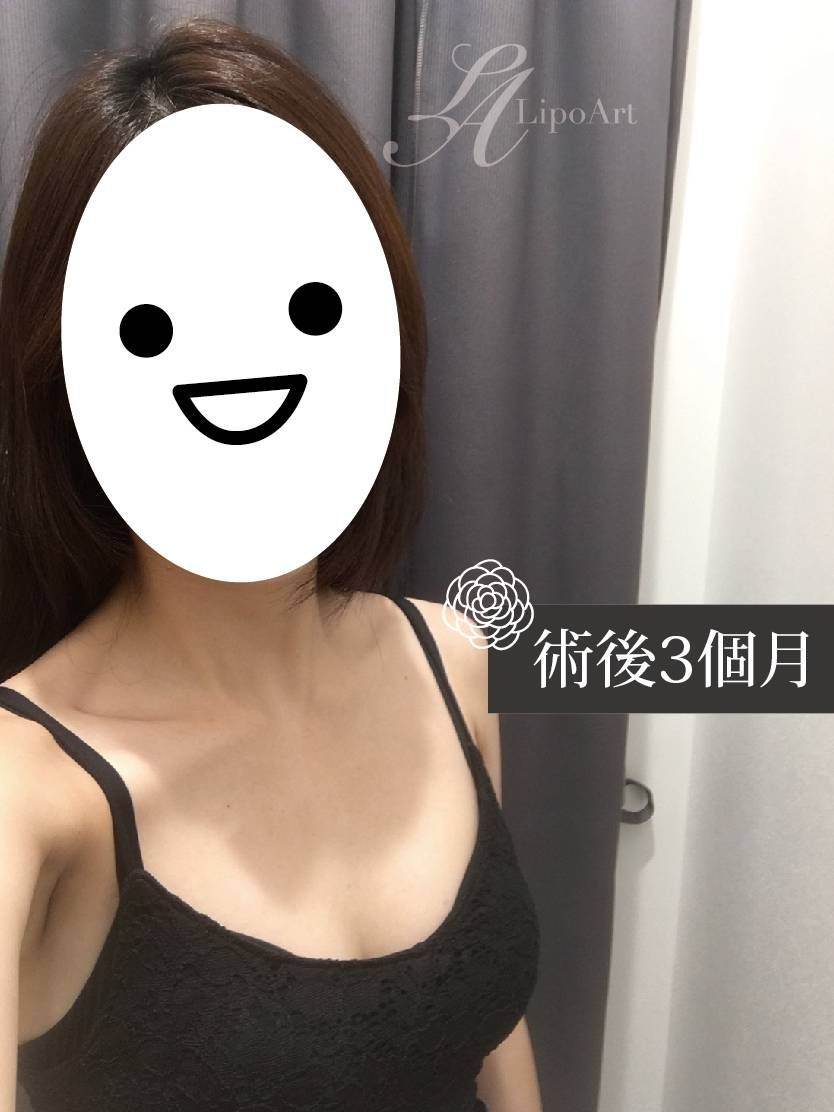 萊波亞