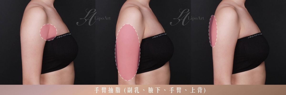 萊波亞