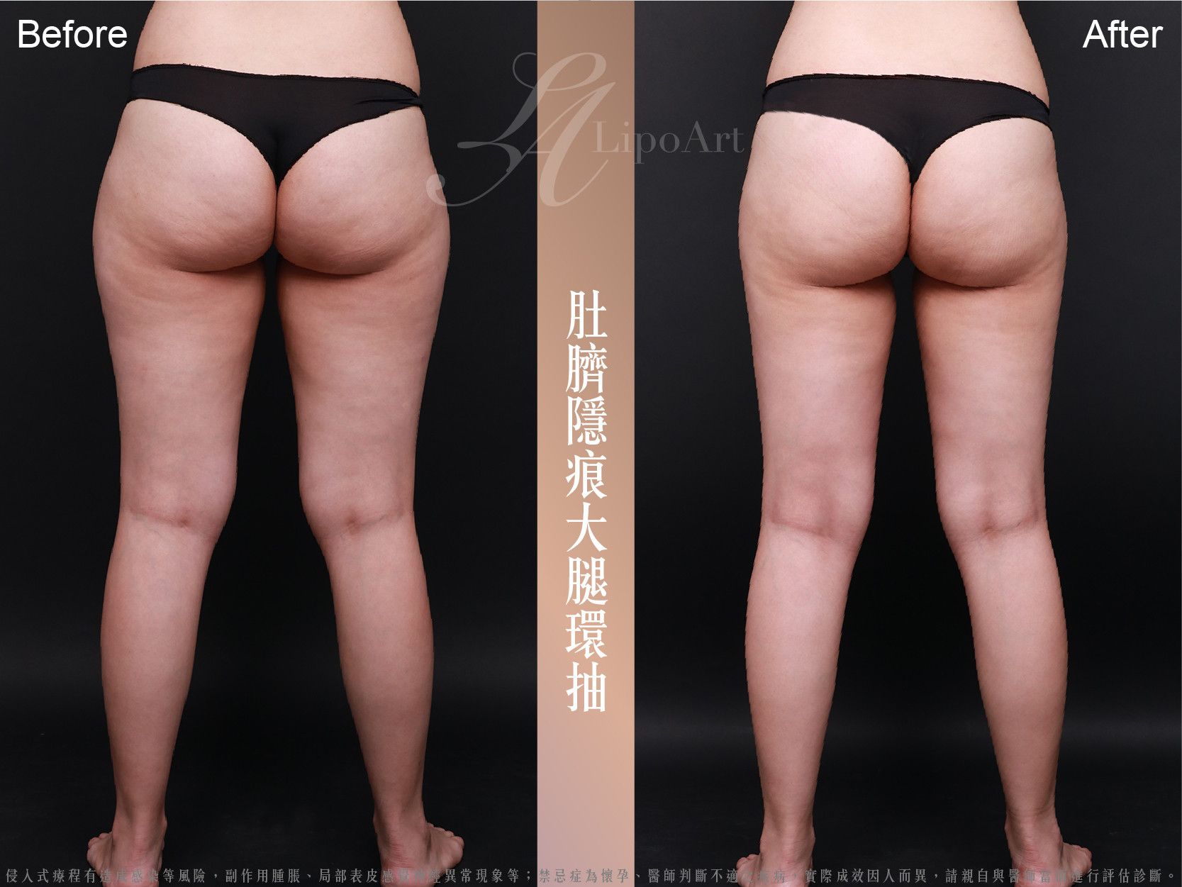 萊波亞