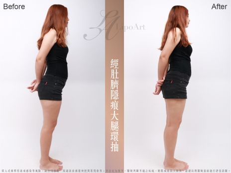 萊波亞 