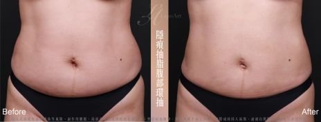 萊波亞 