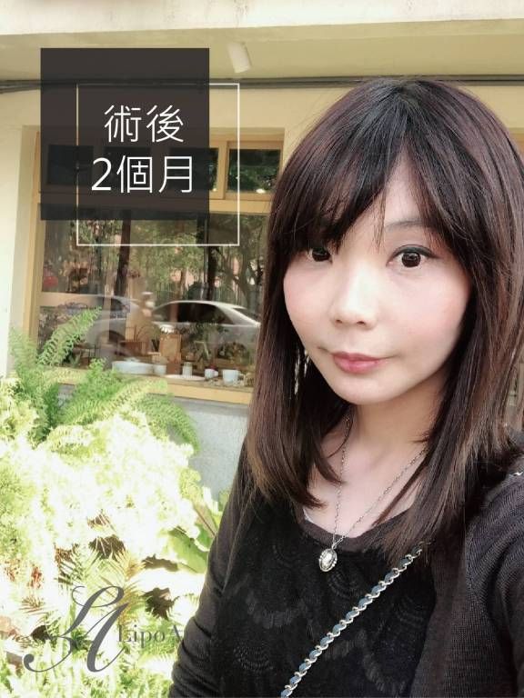萊波亞