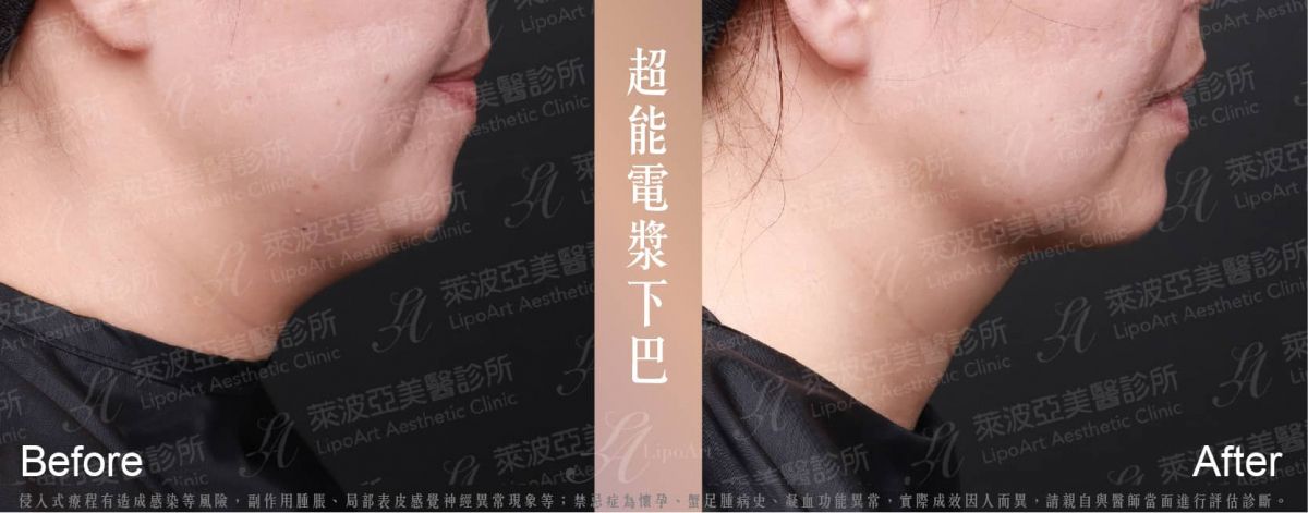 萊波亞