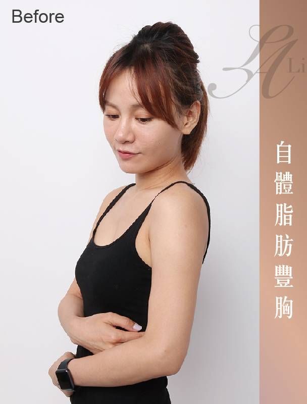萊波亞 