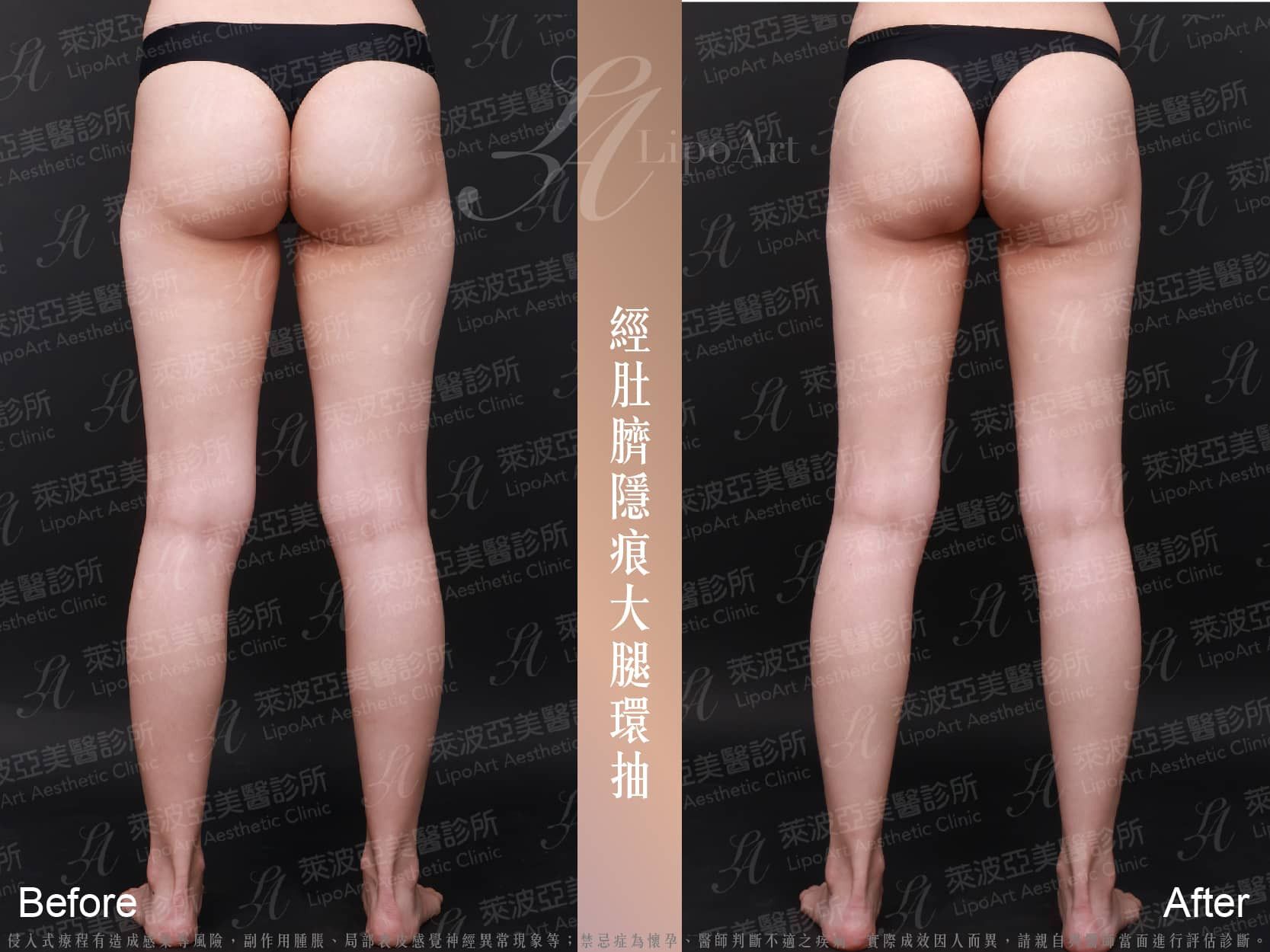 萊波亞