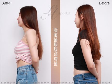萊波亞 