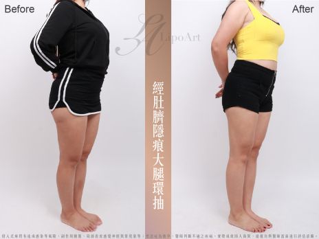 萊波亞 