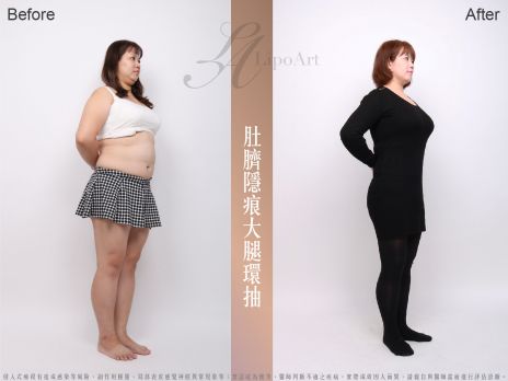 萊波亞