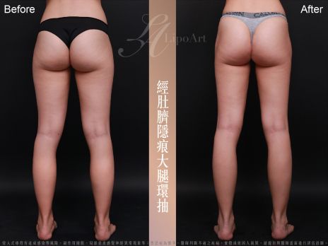 萊波亞 